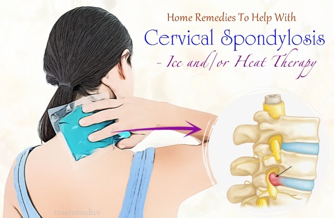 home remedies to help with cervical spondylosis - ice and or heat therapy