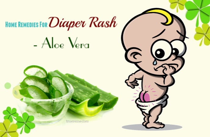 home remedies for diaper rash - aloe vera