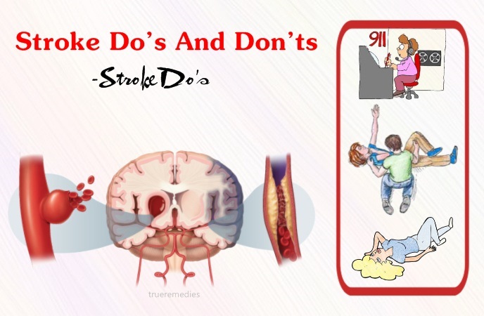 stroke do’s and don’ts - stroke do’s