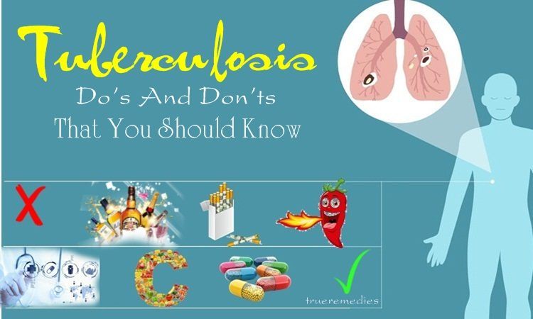 tuberculosis do’s and don’ts that you should know