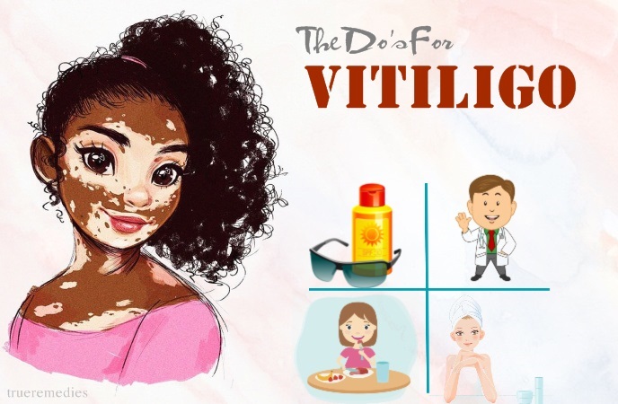 vitiligo do's and don'ts - the do’s for vitiligo