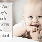 why are baby's teeth growing in crooked and how to fix