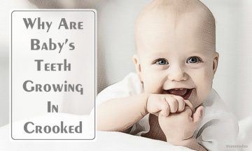 why are baby's teeth growing in crooked and how to fix