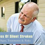 silent stroke: signs, silent strokes treatments