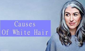 causes of white hair at an early age