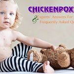 chickenpox faqs & experts’ answers
