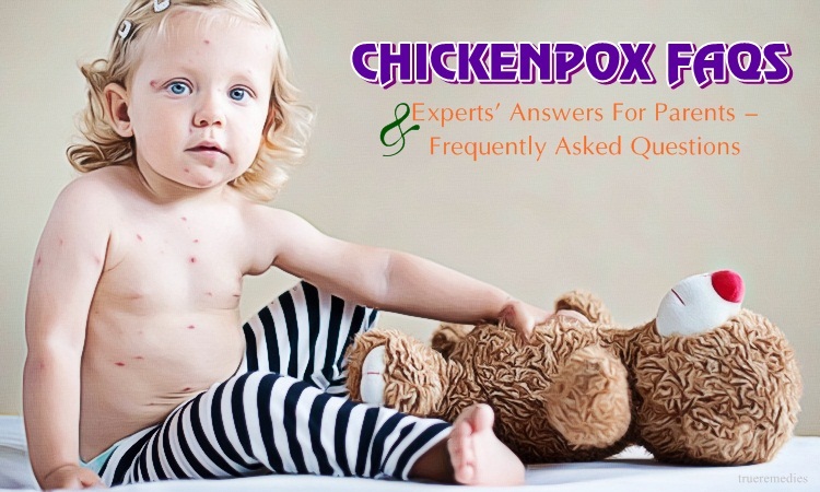 chickenpox faqs & experts’ answers