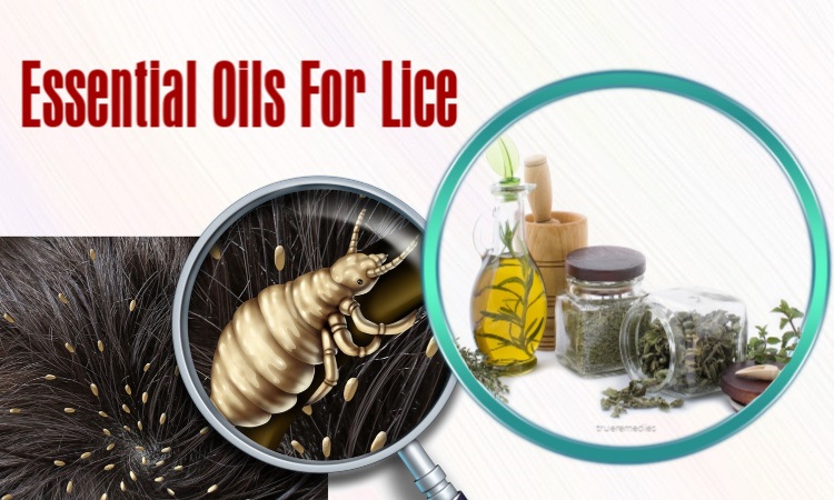 enefits of essential oils for lice