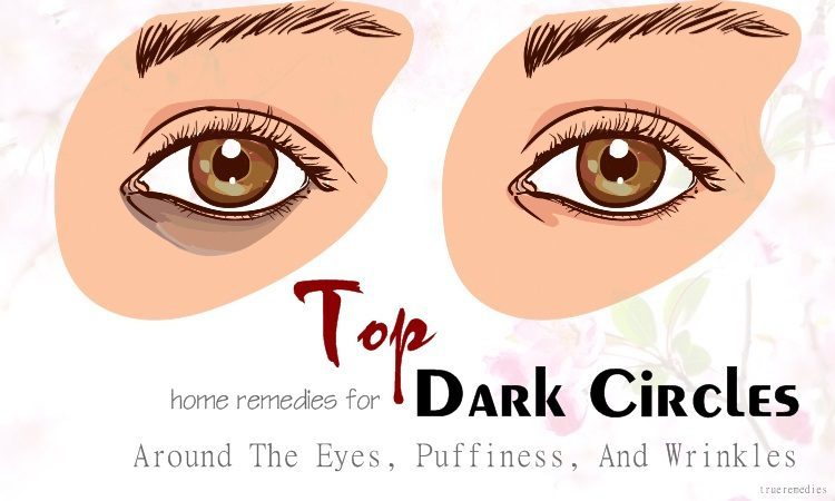 home remedies for dark circles around the eyes