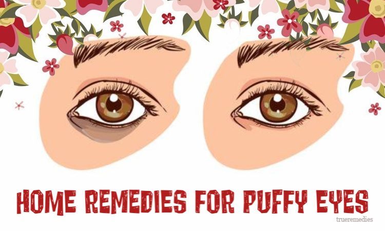 home remedies for puffy eyes from allergies