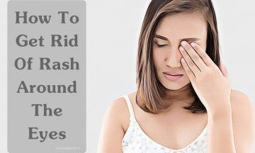 how to get rid of rash around the eyes naturally