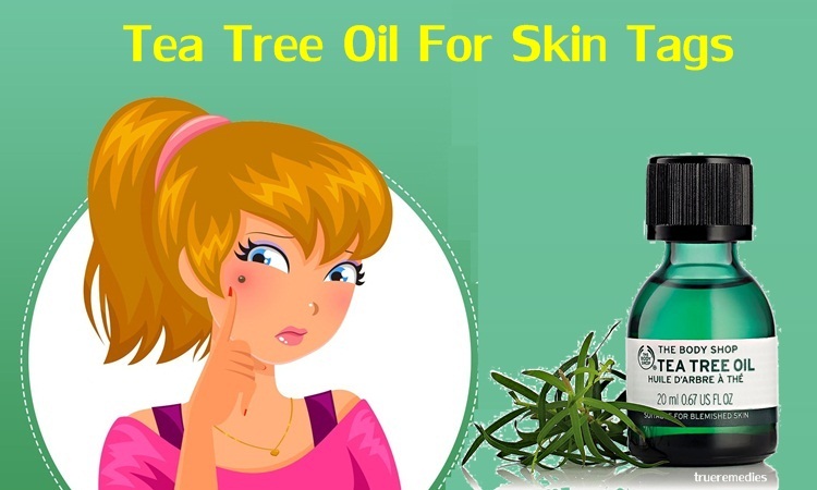 uses of tea tree oil for skin tags and warts removal