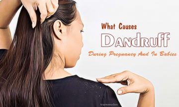 what causes dandruff during pregnancy