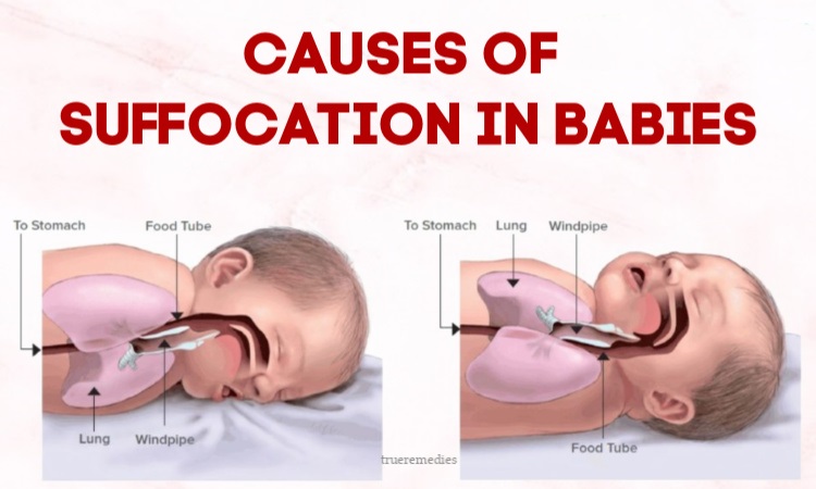 common causes of suffocation in babies