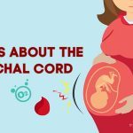 exciting facts about the nuchal cord