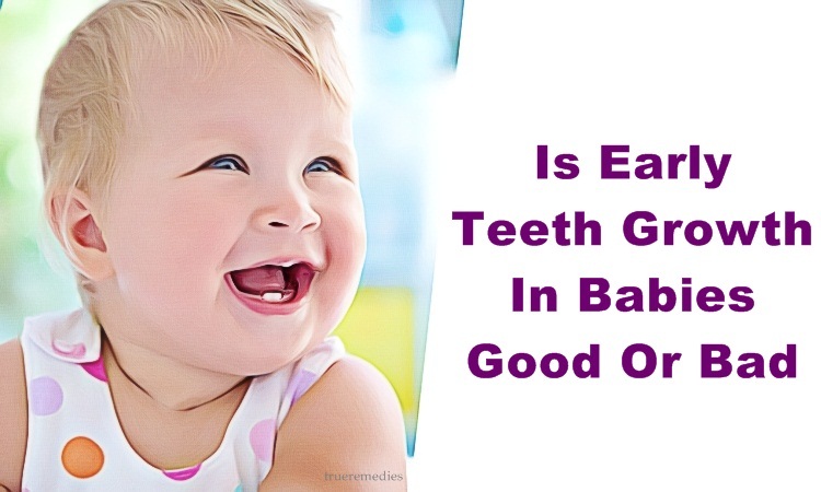 is early teeth growth in babies good or bad for their development