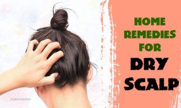 best home remedies for dry scalp