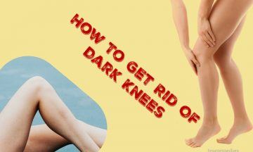 how to get rid of dark knees and elbows